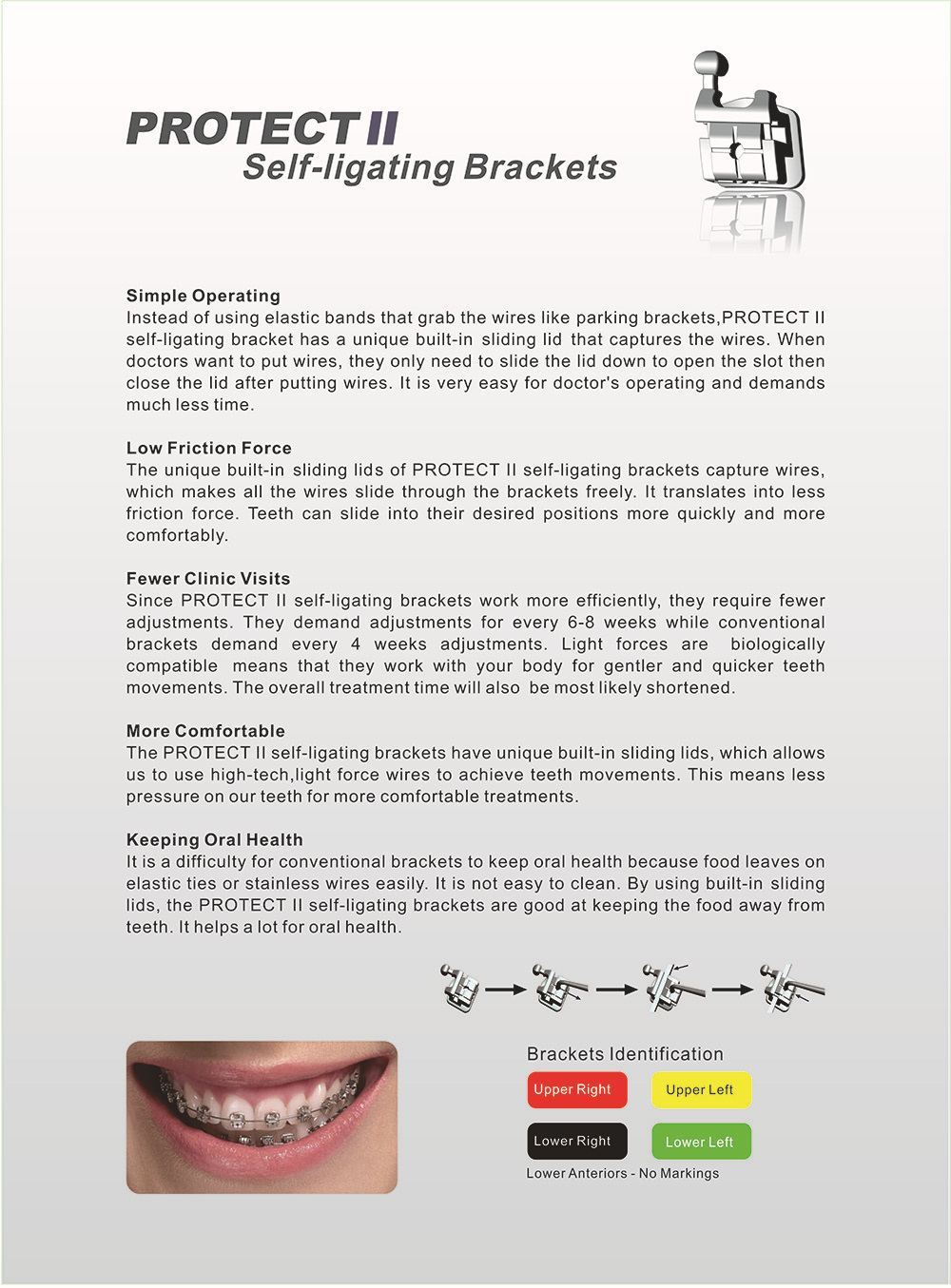 Title: Custom Metal End Tooth Manufacturing: A Comprehensive Guide