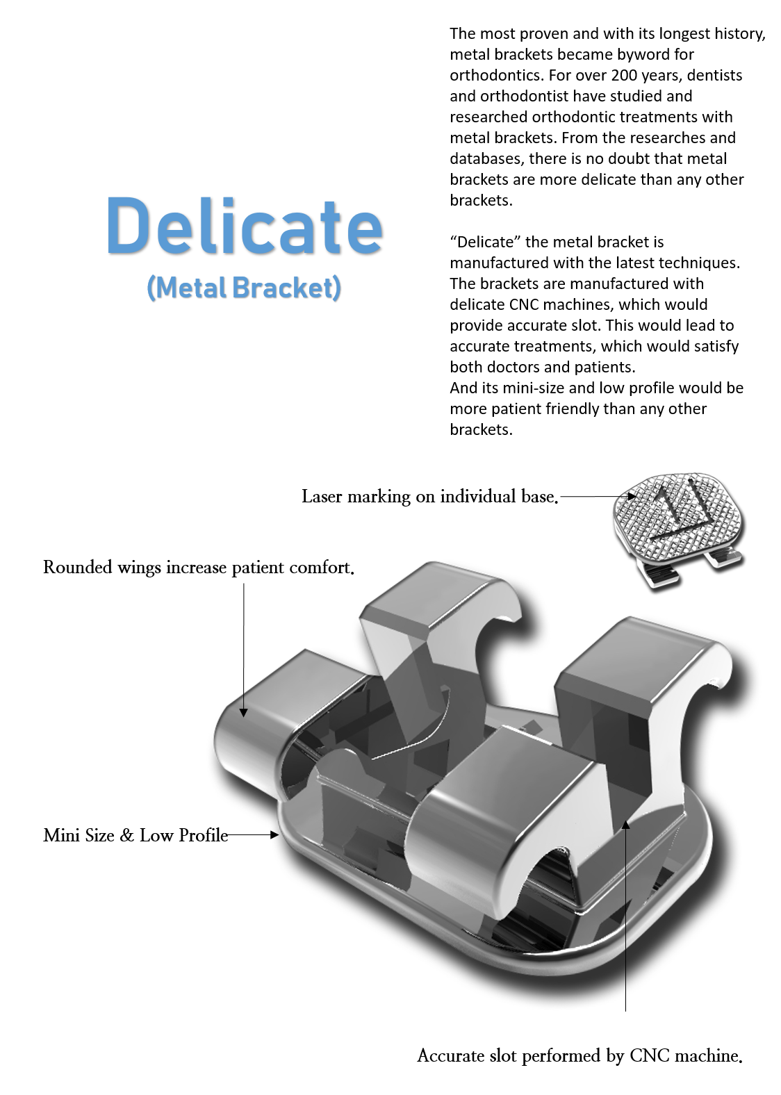Customized Metal Brackets: The Ultimate Guide